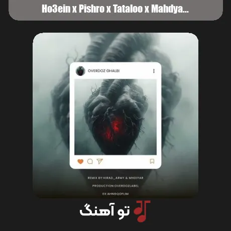 حصین و پیشرو و تتلو و مهدیار اوردوز قلبی